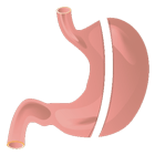 Sudoración excesiva (Hiperhidrosis)